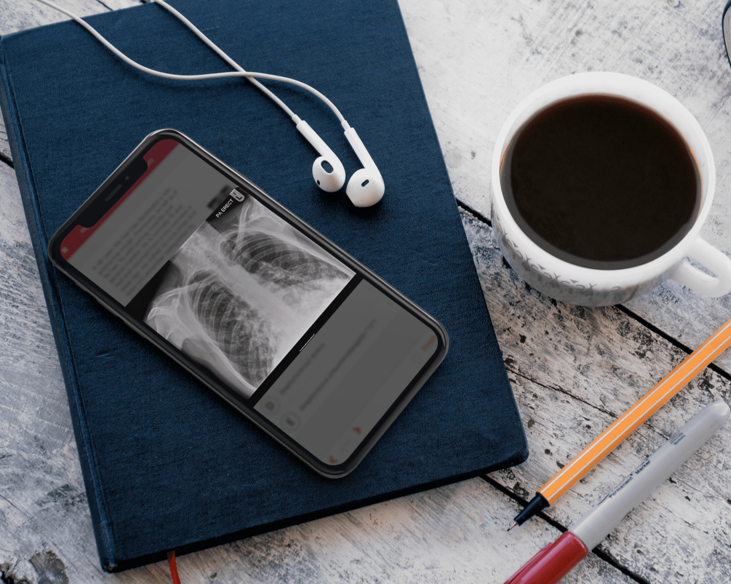 X-ray image displayed on an iPhone screen led on top of a notepad.