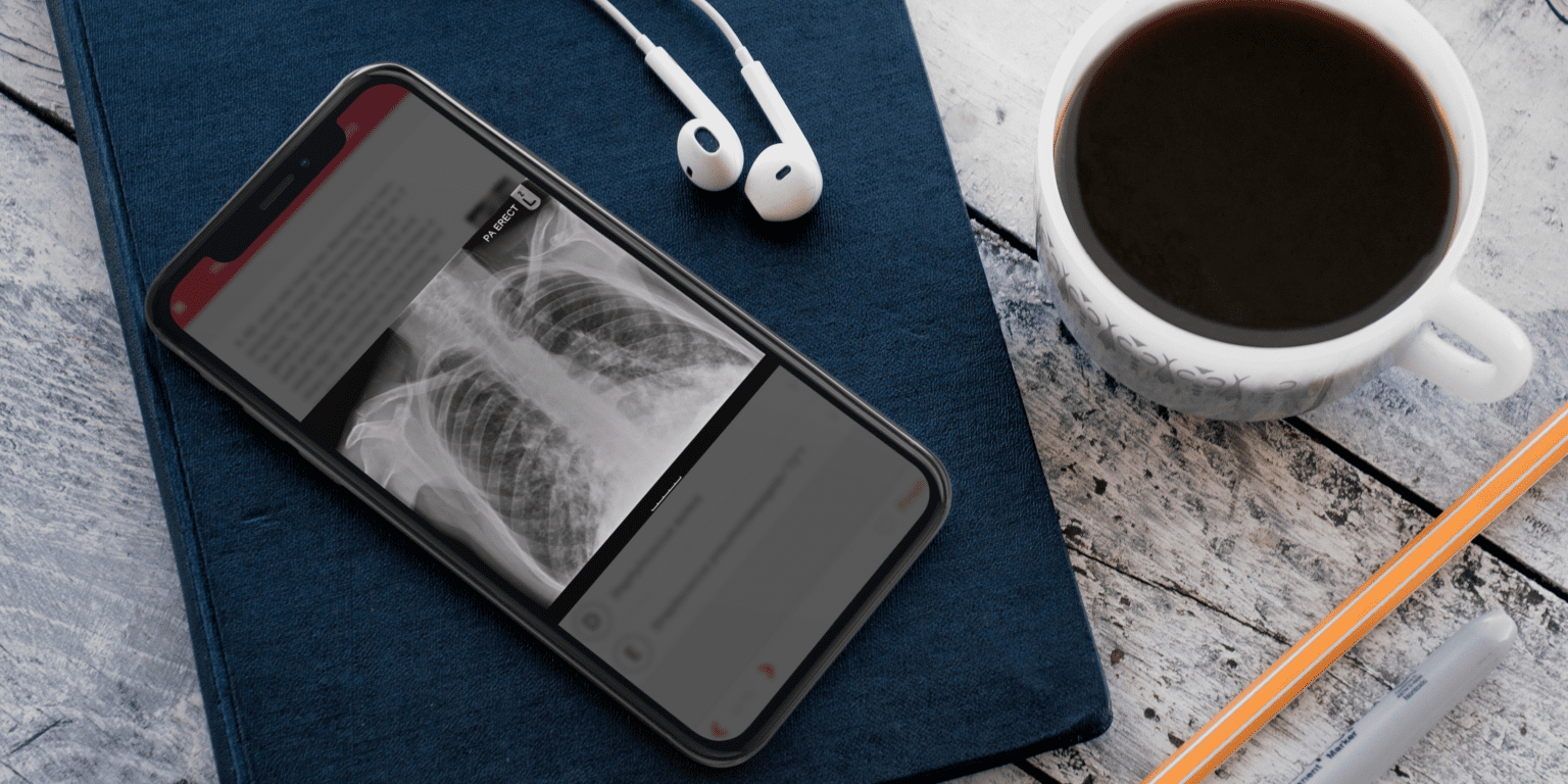 X-ray image displayed on an iPhone screen led on top of a notepad.