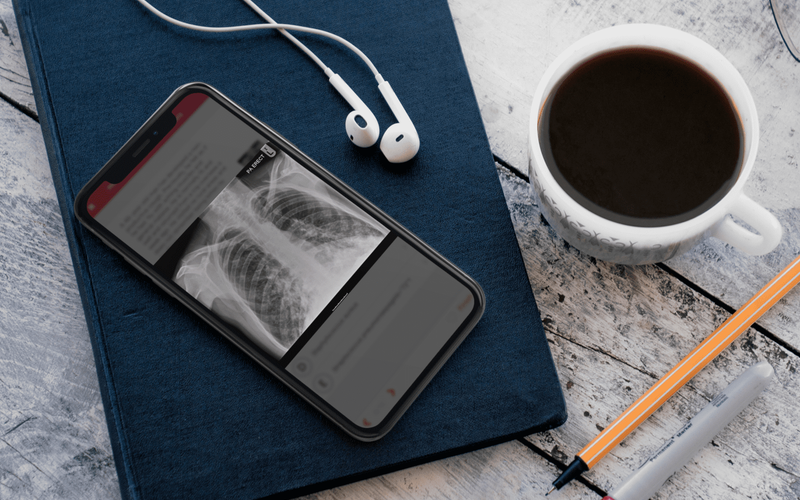 X-ray image displayed on an iPhone screen led on top of a notepad.