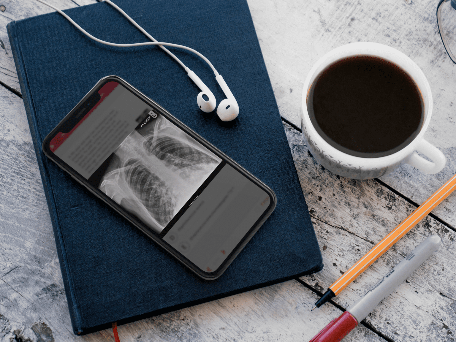 X-ray image displayed on an iPhone screen led on top of a notepad.